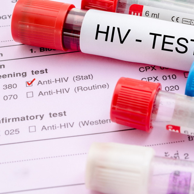 анализы на ВИЧ и СПИД